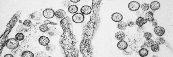 Yosemite: Acht Hantavirus-Fälle